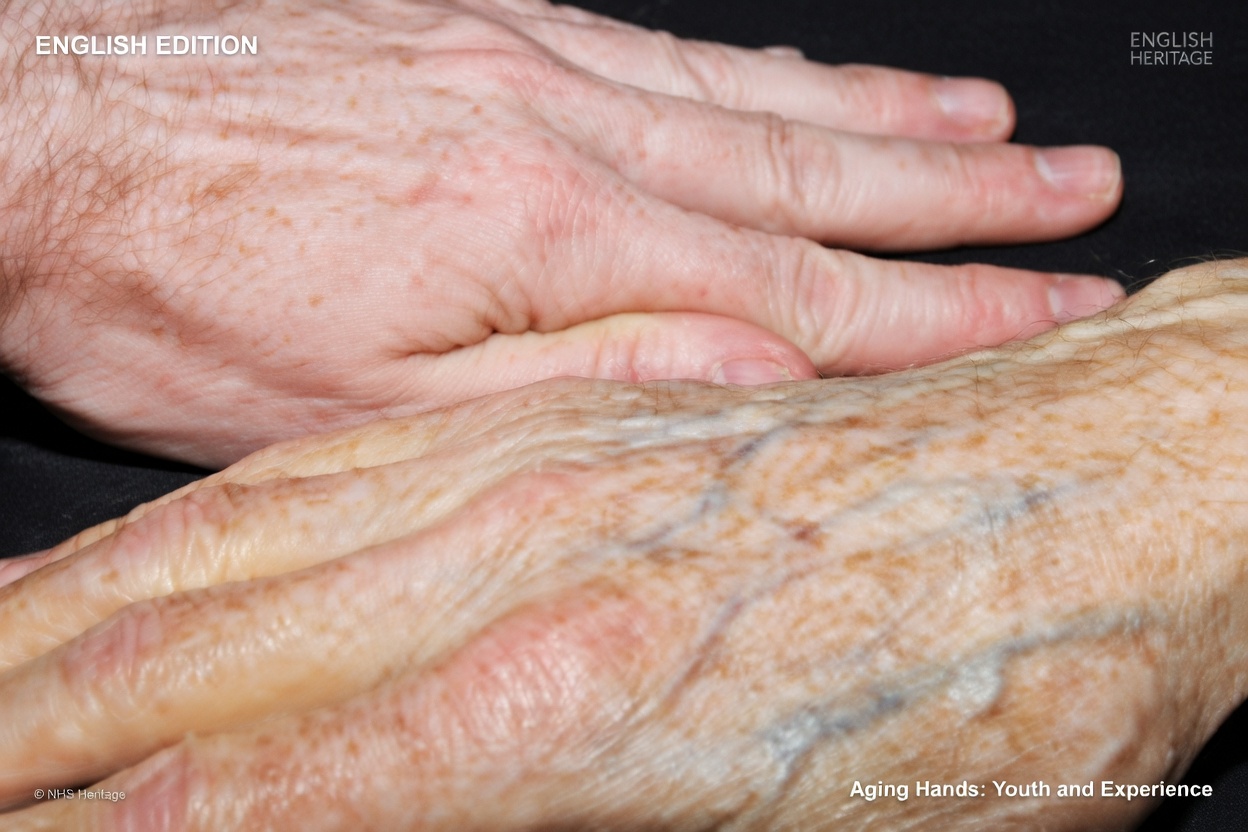 8 Strange Signs Your Body Is Begging for Vitamin B12 That Seniors Often Miss After Age 60