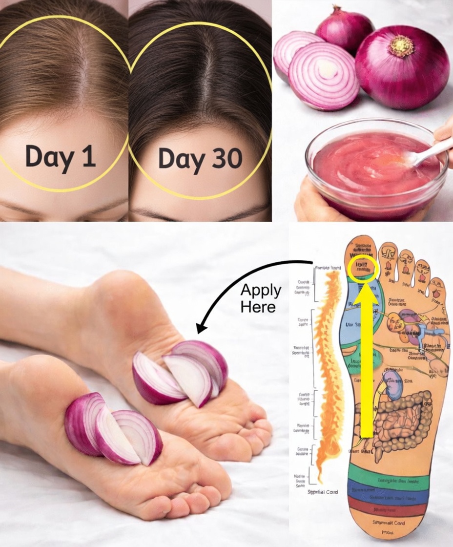 14 Ingenious Ways Onions Can Improve Your Health at Home