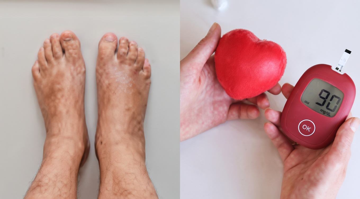 Seniors, Are Your Legs Whispering Warnings You Can’t Ignore? 4 Vitamins That May Support Healthy Leg Circulation