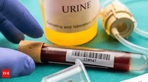 Top 10 Warning Signs Your Body Is Giving You About Proteinuria and Kidney Issues (Don’t Ignore #1)