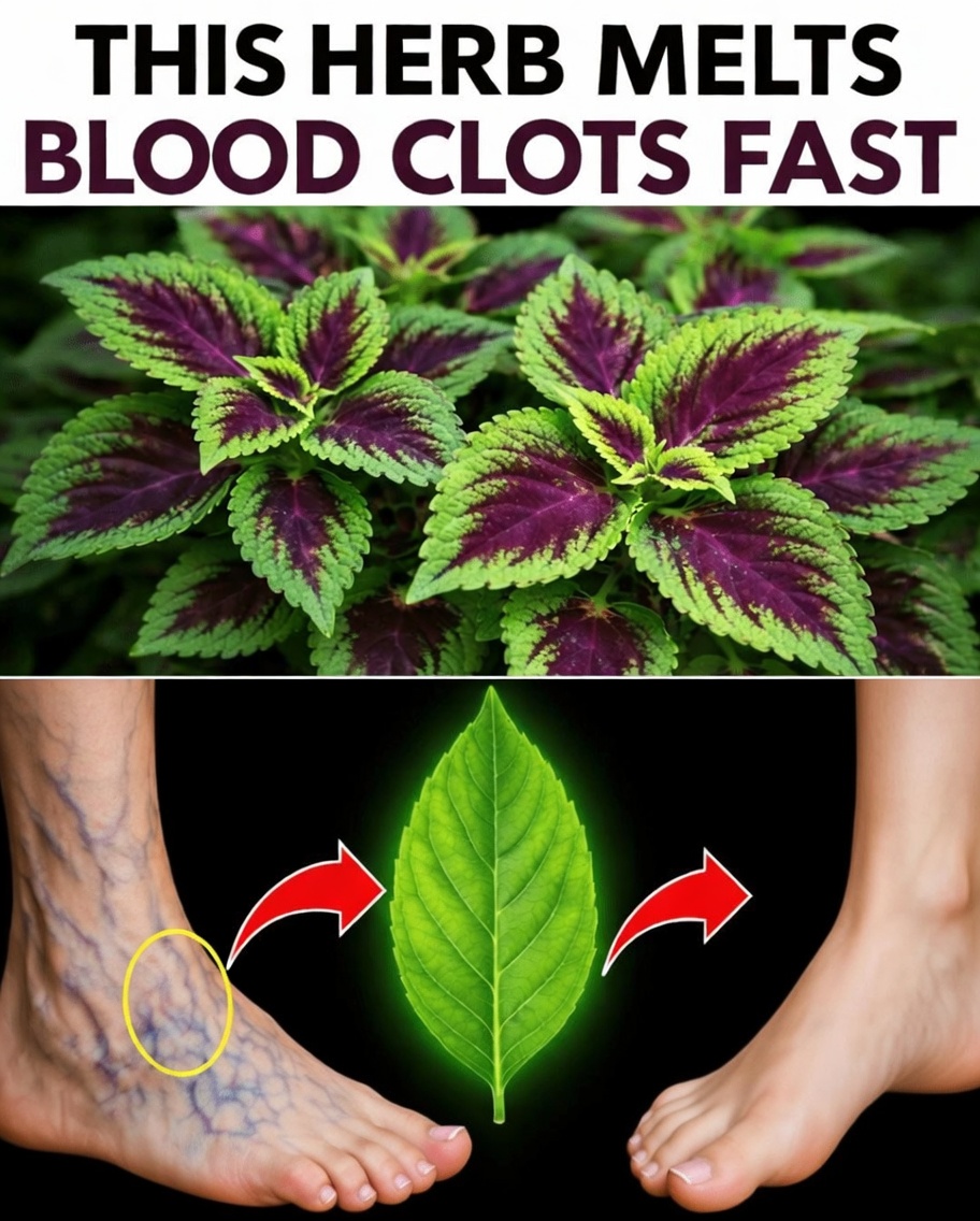 Discover 6 Powerful Herbs That May Help Support Healthy Circulation and Leg Comfort Naturally After 45