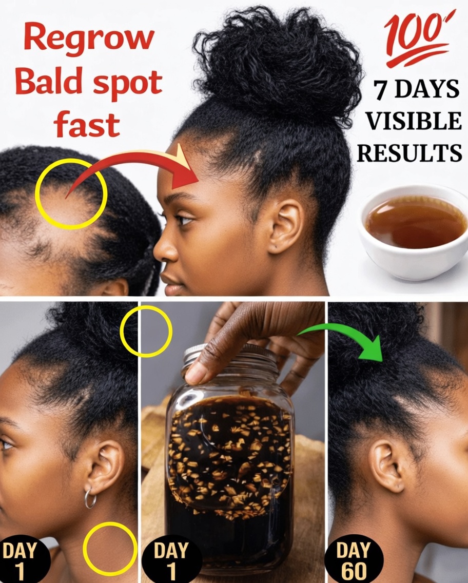 Cloves, Rosemary, and Ginger: The Simple 3-Ingredient Hair Growth Tonic That’s Shocking People (Better Than Aloe Vera?)