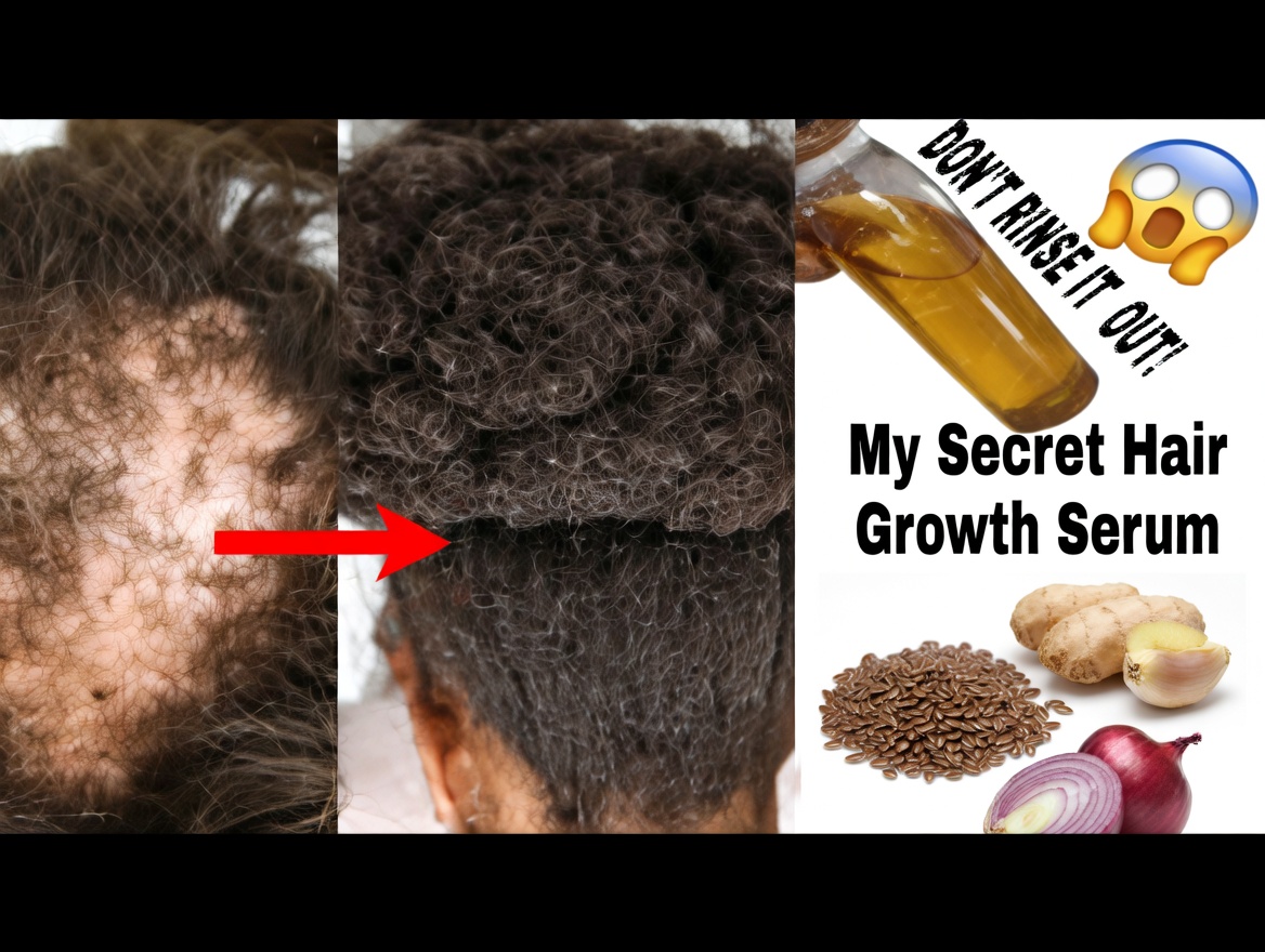Cloves, Rosemary, and Ginger: The Simple 3-Ingredient Hair Growth Tonic That’s Shocking People (Better Than Aloe Vera?)