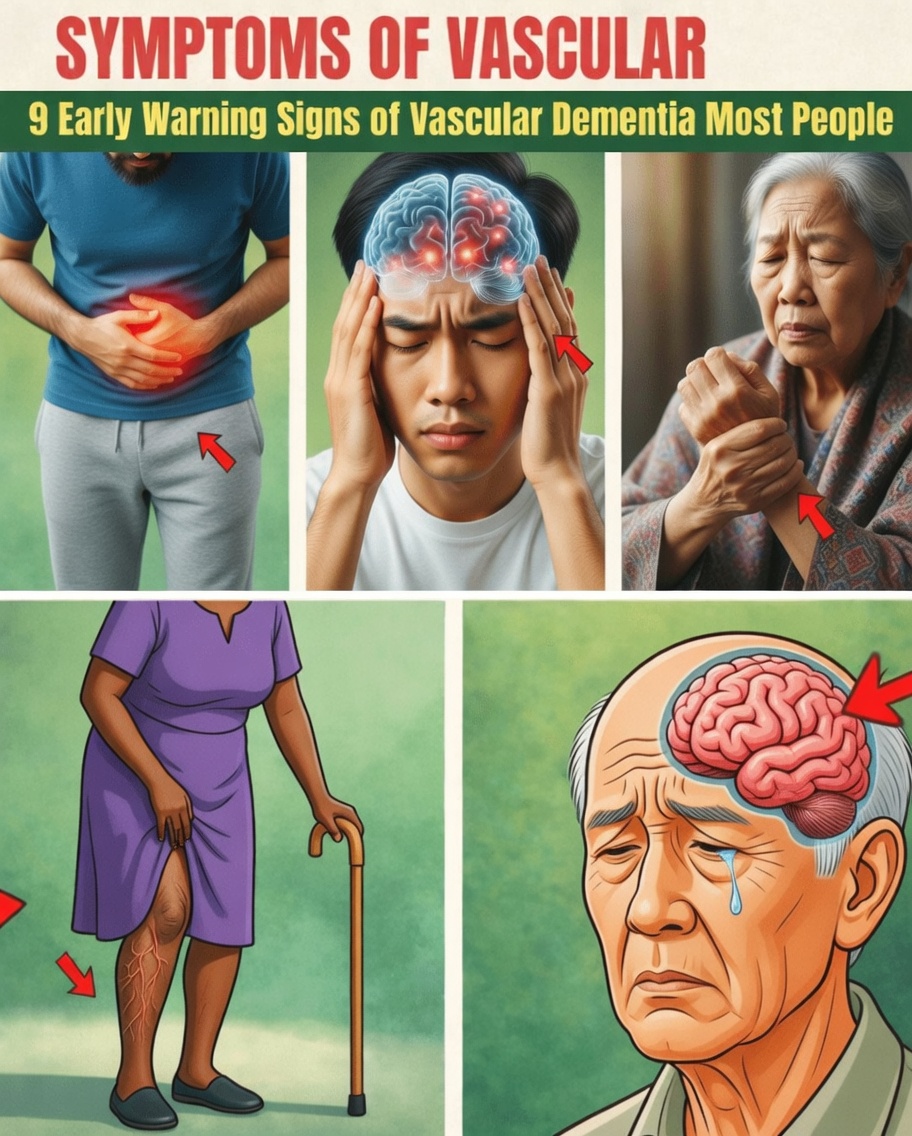 Early Signs of Vascular Dementia (Most People Miss #3) – What Your Brain Is Quietly Telling You Before It’s Too Late