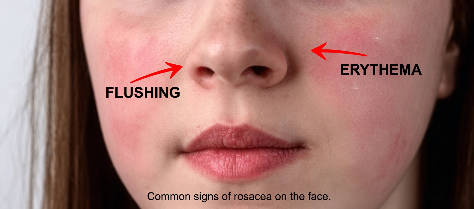 12 Side Effects of Amlodipine Every Adult Over 45 Taking Blood Pressure Pills Should Understand