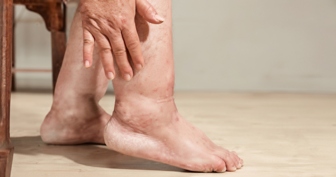 Women Over 60: 10 Leg Warning Signs You Shouldn’t Ignore – Watch Out for #7!