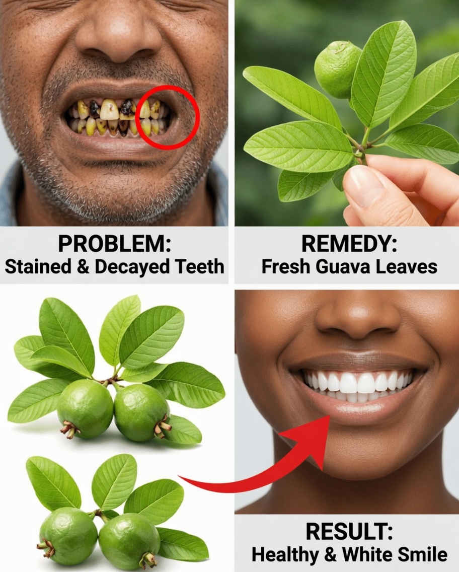 Unlock Nature’s Secret for Your Smile: Top 3 Guava Leaf Remedies to Support Daily Oral Care