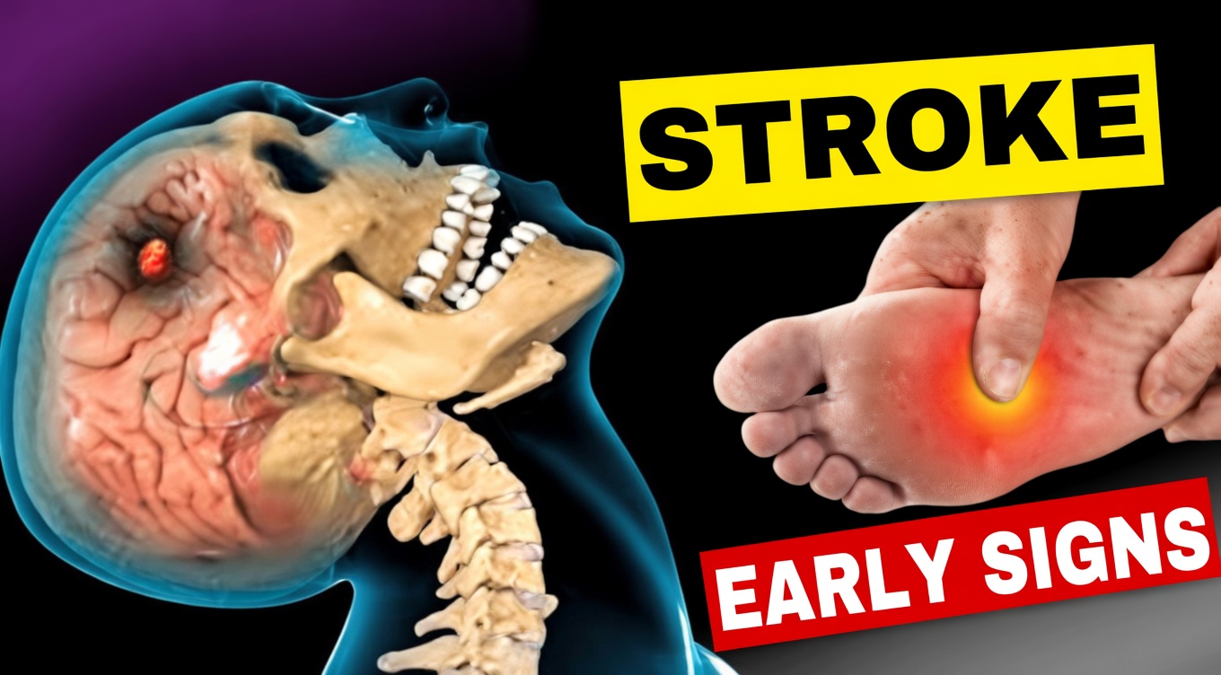 8 Warning Signs of Stroke That May Appear One Month Before + 9 Powerful Tips to Prevent It