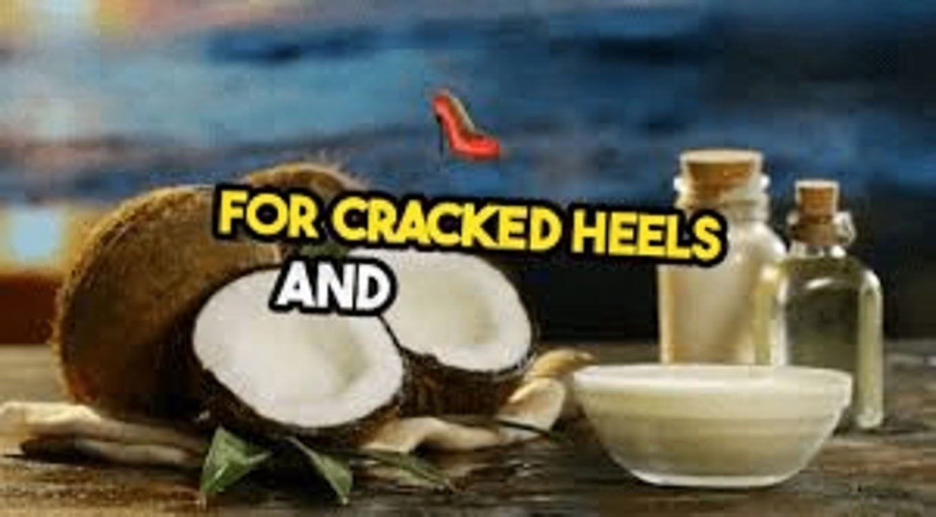 5 Natural Home Remedies for Cracked Heels to Help Soften Skin and Restore Foot Comfort