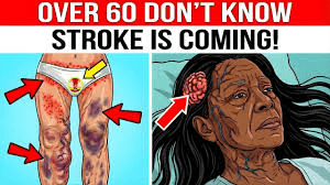 10 Leg Signs That Could Signal a Stroke in Women Over 60 – Don’t Miss Sign #7