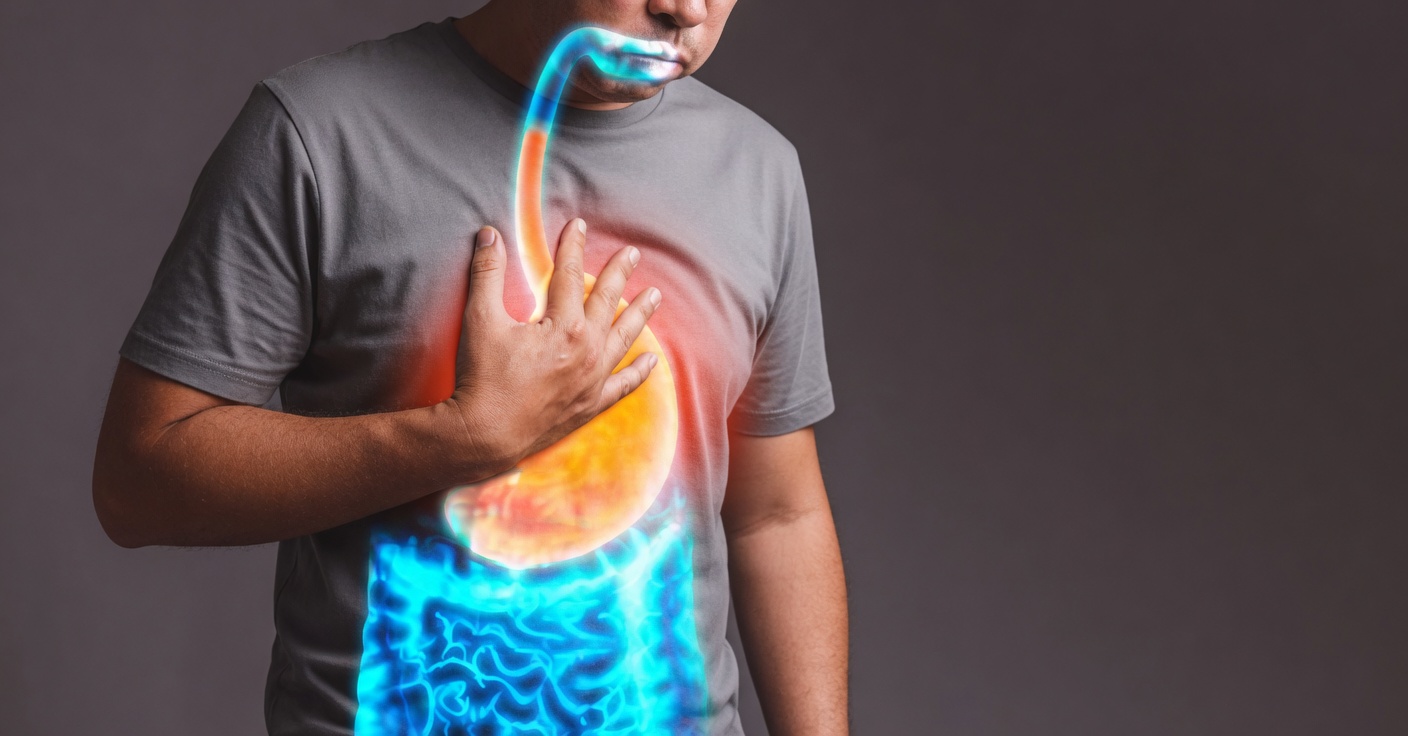 Say Goodbye to Heartburn and Bloating: Discover How to Kill the Bacteria Causing It!