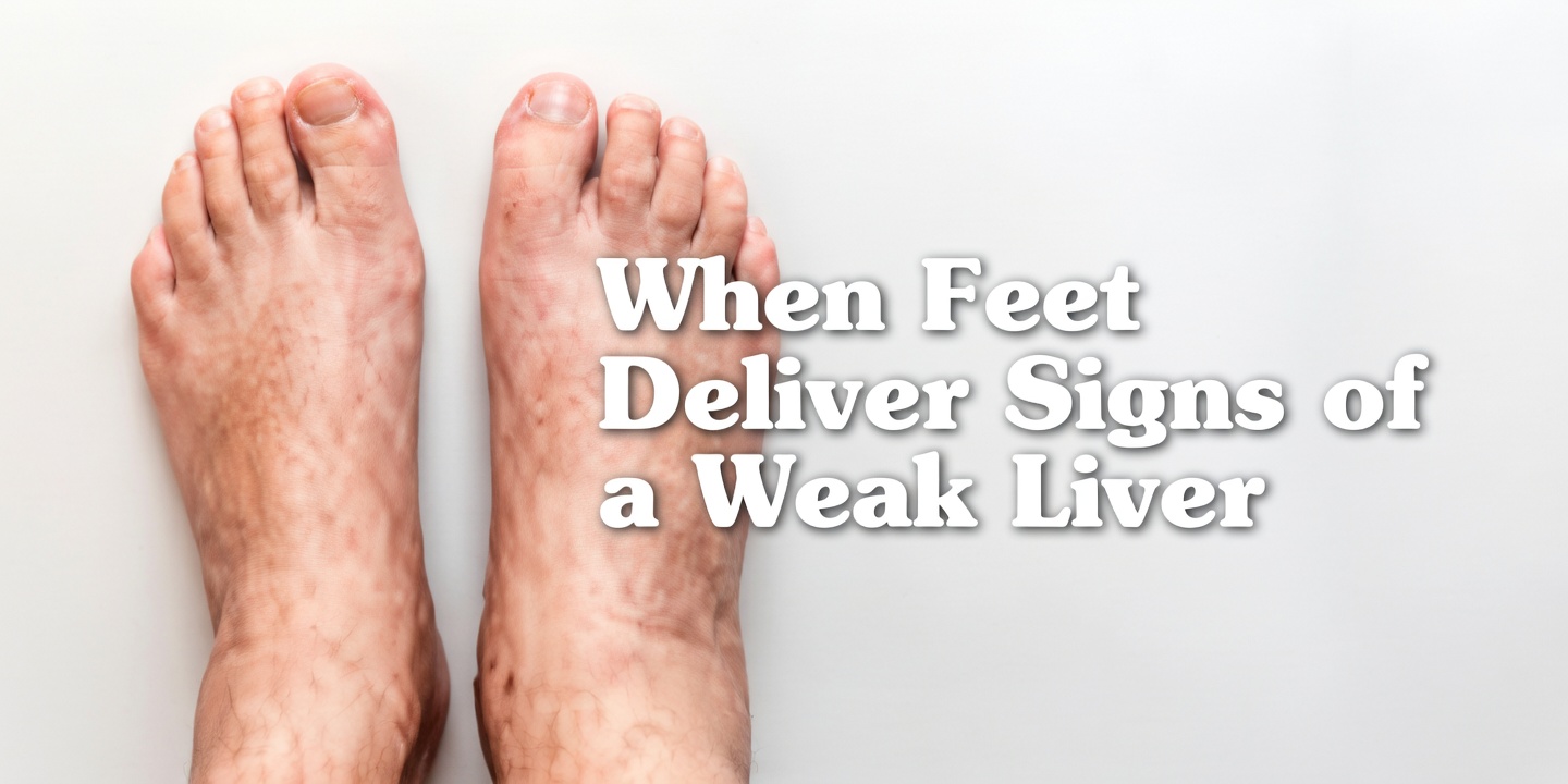How Your Feet Are Warning You About Liver Problems: Don’t Miss These Subtle Signs