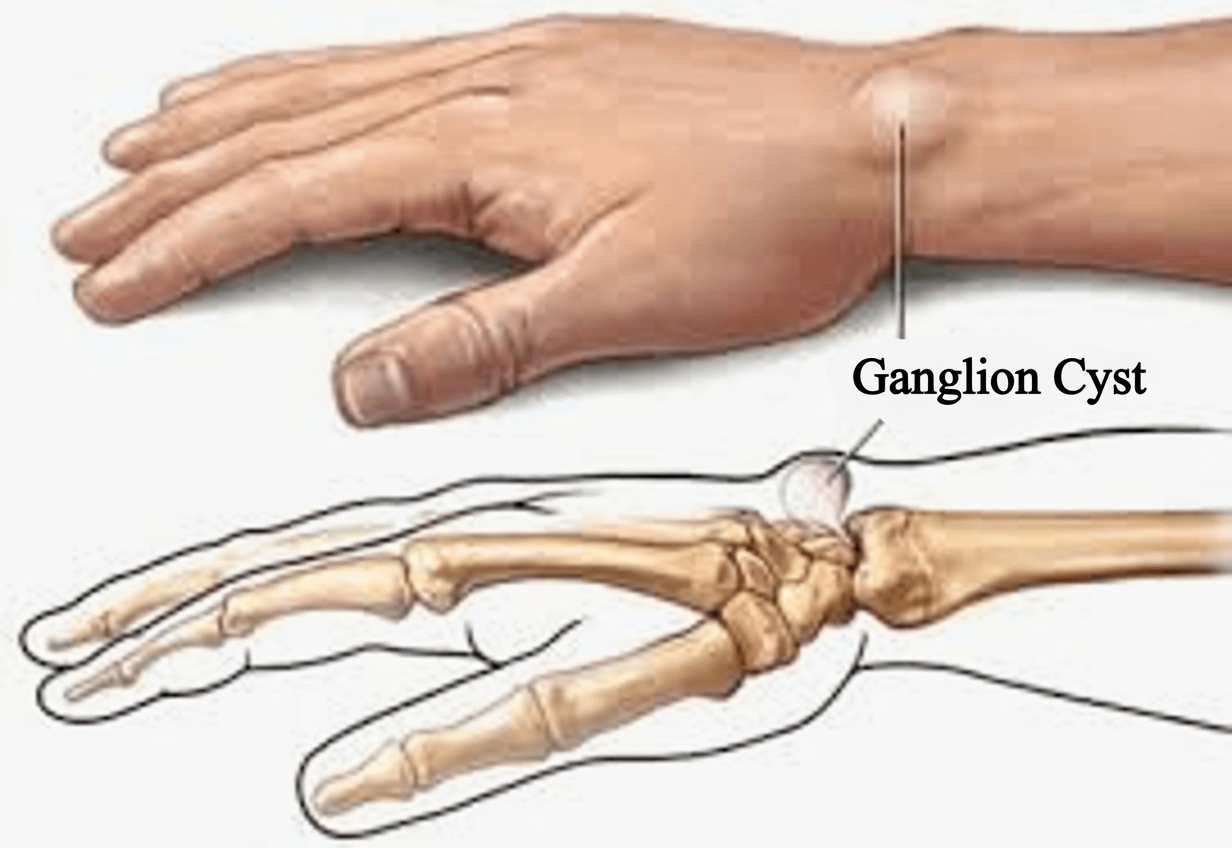 My grandmother developed this strange lump on her wrist overnight. What could this be? I’m worried because it looks abnormal