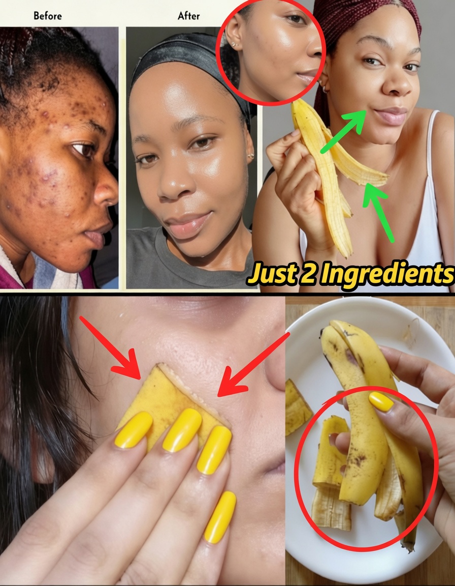 7 Natural Ways to Smooth Fine Lines & Boost Skin Glow Using Banana Peels