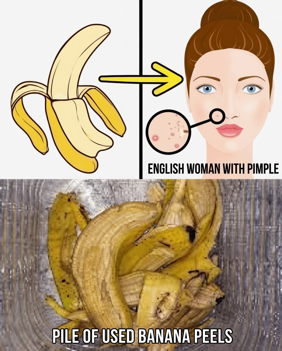 7 Natural Ways to Smooth Fine Lines & Boost Skin Glow Using Banana Peels