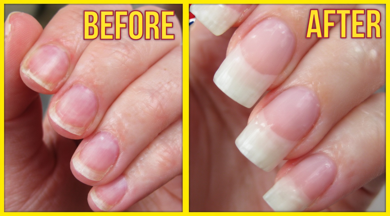 How to Grow Your Nails Noticeably Longer and Stronger Naturally in Just 10 Days