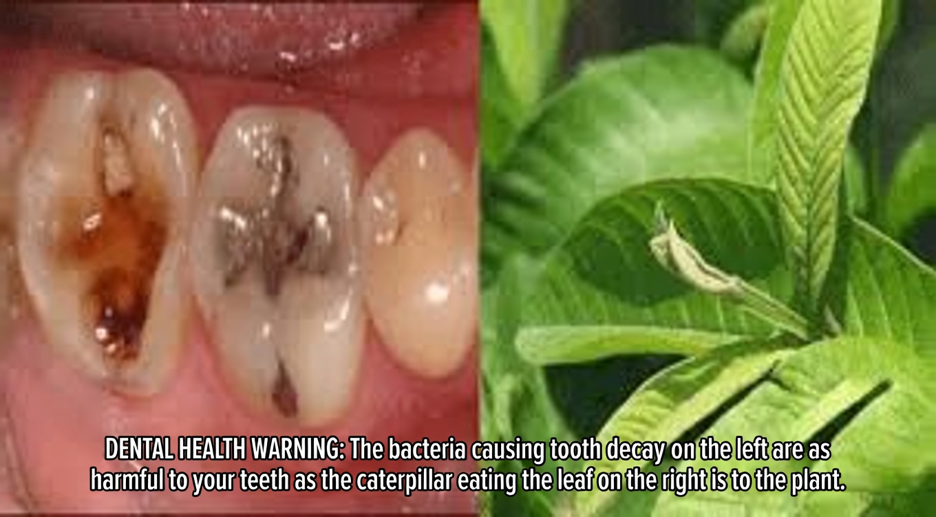 Top 3 Simple Ways to Use Guava Leaves to Support Healthier Teeth and Gums at Home