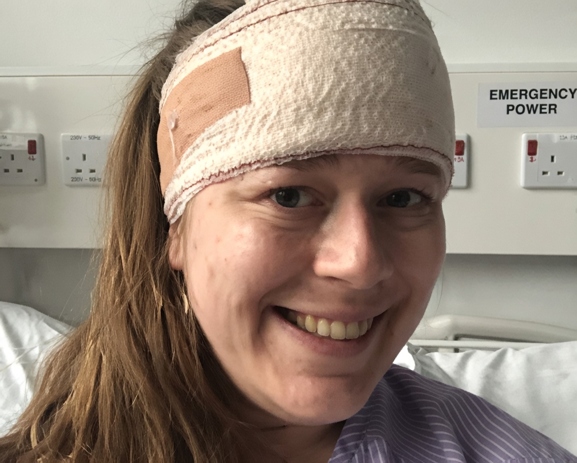 Don’t Miss These 8 Early Warning Signs of a Brain Tumor – Recognizing Them Could Save Your Life