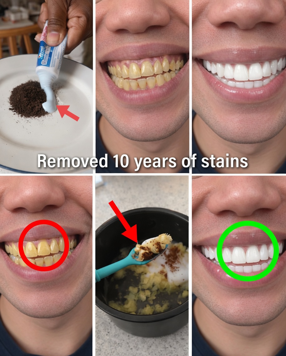 In Just 2 Minutes, Remove 10 Years of Teeth Stains – The Natural Whitener That Actually Works