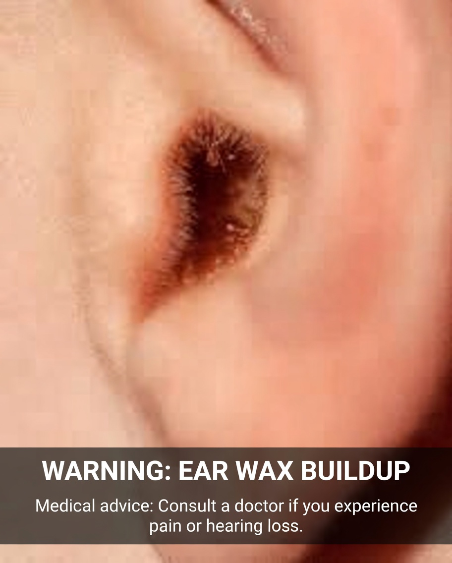 Ear Hair and Your Health: What Doctors Say About This Overlooked Body Sign