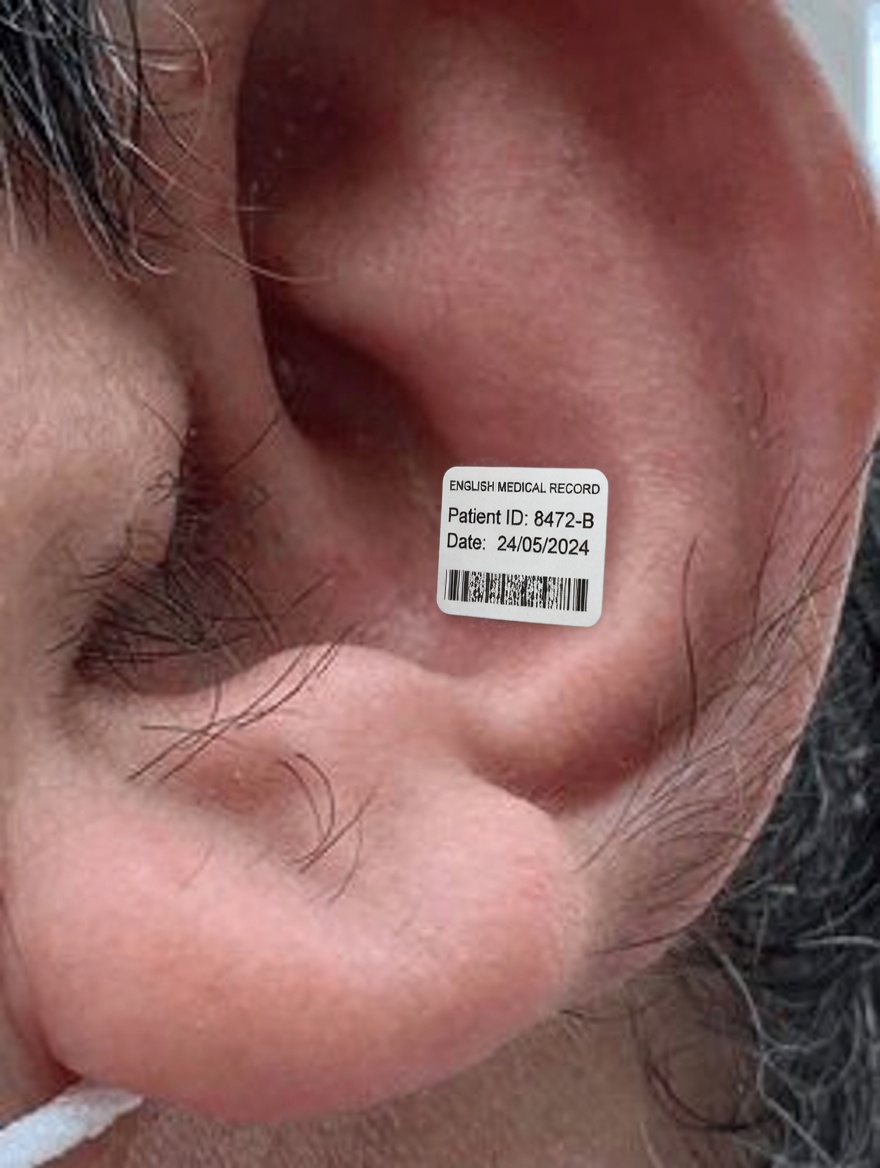 Ear Hair and Your Health: What Doctors Say About This Overlooked Body Sign