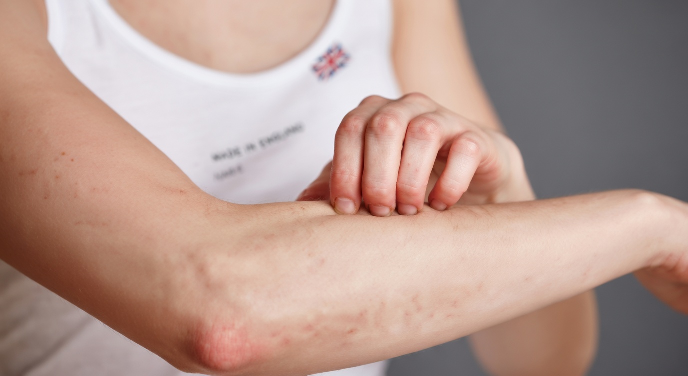 11 Strange Signs of Liver Damage You Should Not Ignore