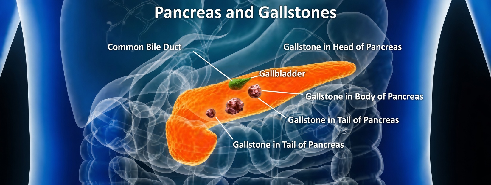 12 Early Warning Signs of Pancreatic Cancer You Should Never Ignore and How to Recognize Them