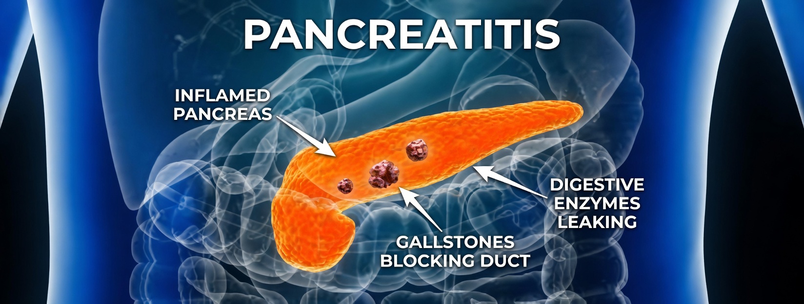 10 Shocking Warning Signs of Pancreatic Cancer You Can’t Ignore