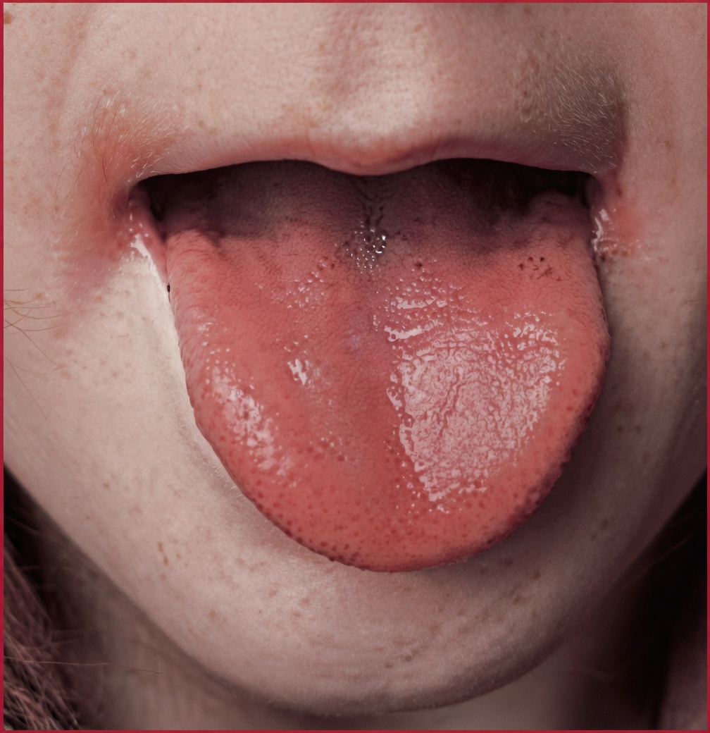 If You’re Experiencing These Four Tongue Symptoms, They Could Indicate Underlying Health Conditions