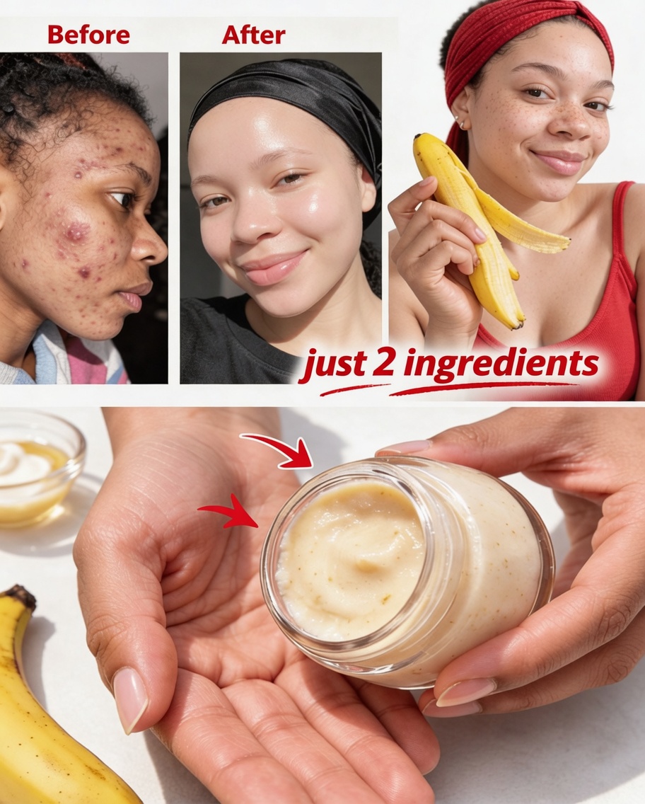 7 Natural Ways to Smooth Fine Lines & Boost Skin Glow Using Banana Peels