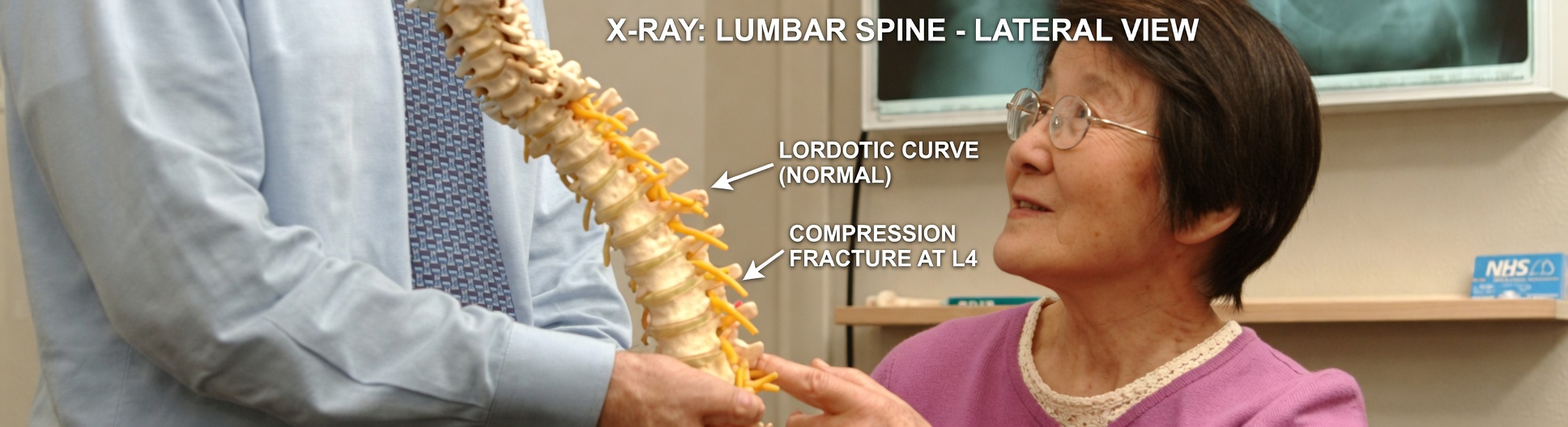 Japan’s Oldest Doctor: Reverse Osteoporosis With 6 Life-Changing Tips — Boost Bone Density Fast