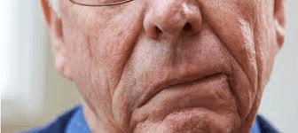 10 Silent Mini-Stroke Symptoms That People Over 60 Often Miss (Especially #4 – The “Senior Moment” Sign)