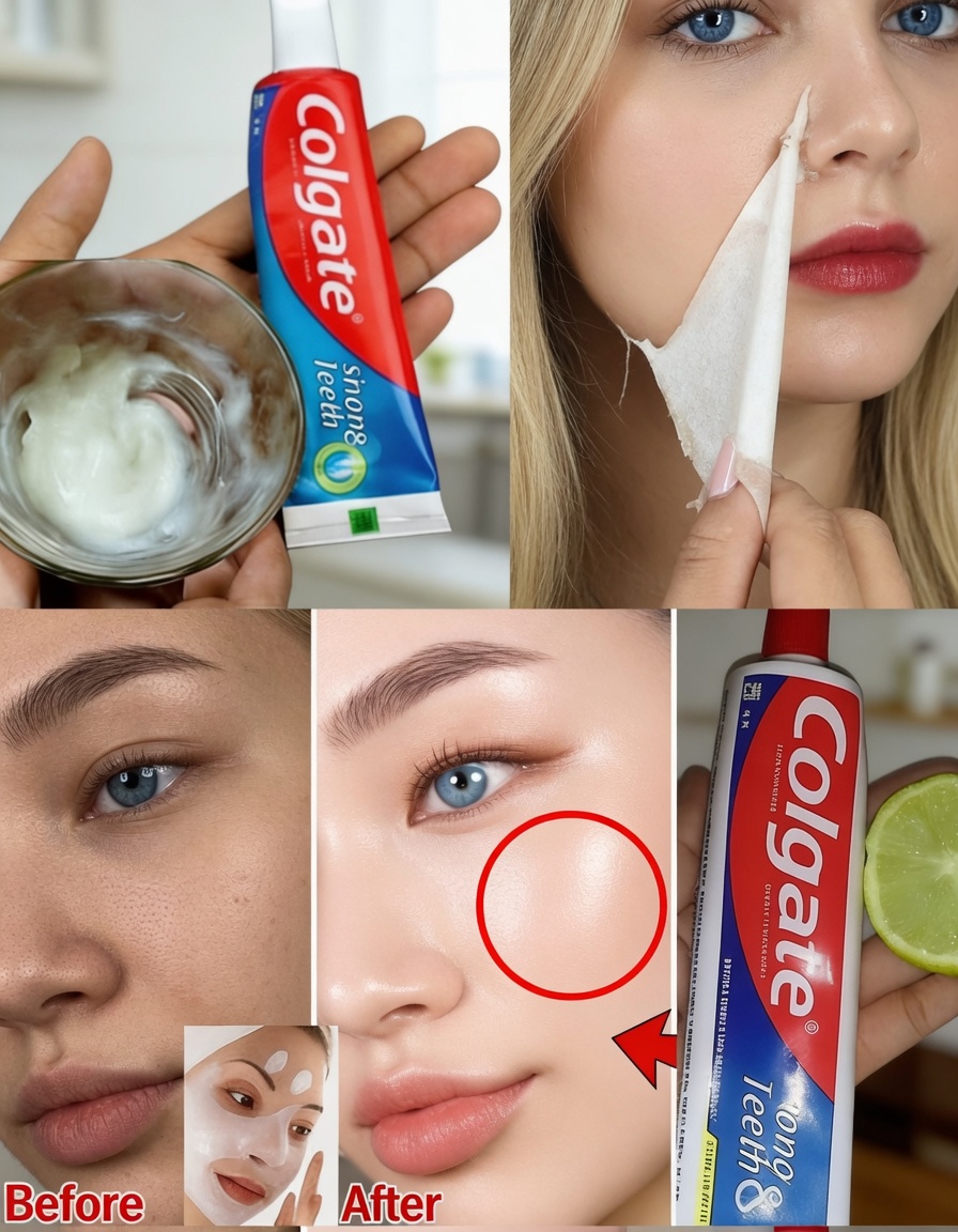 Colgate Toothpaste for Face Whitening with Lemon: What You Need to Know About This Popular Home Remedy