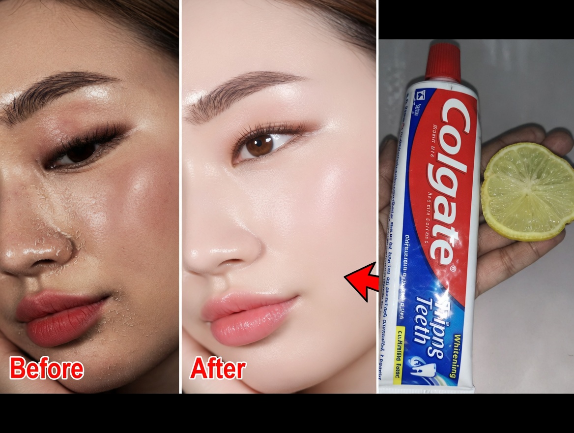 Colgate Toothpaste for Face Whitening with Lemon: What You Need to Know About This Popular Home Remedy