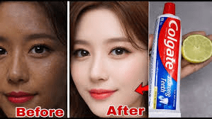 Colgate Toothpaste for Face Whitening with Lemon: What You Need to Know About This Popular Home Remedy