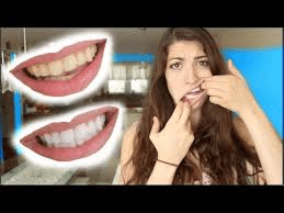 Whiten Your Teeth Instantly with This 2-Minute Ginger and Salt Trick. Here’s How