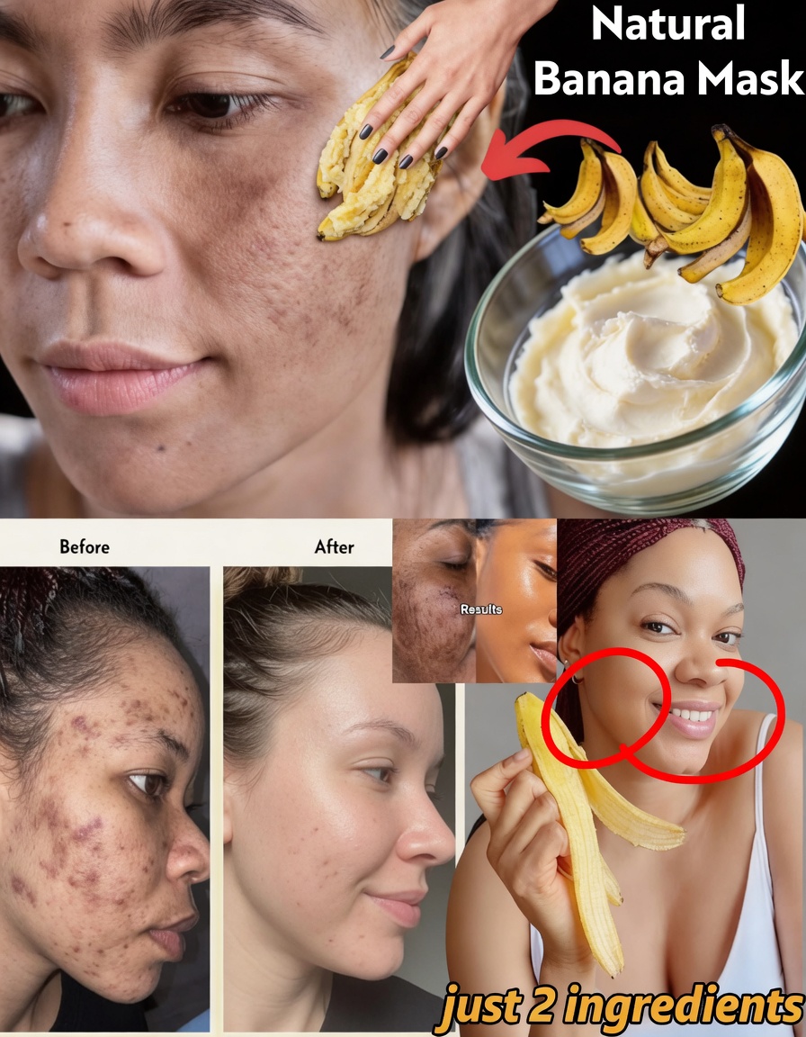 7 Natural Ways to Smooth Fine Lines & Boost Skin Glow Using Banana Peels