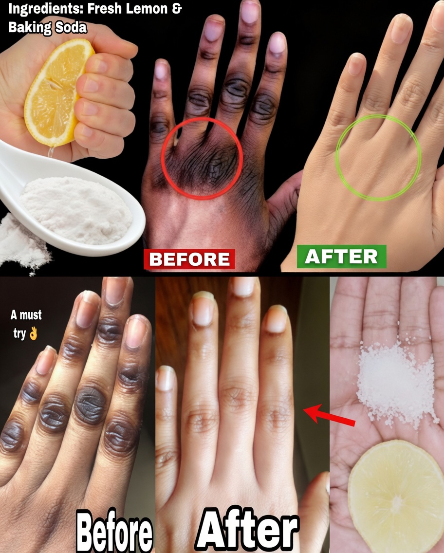 How I Keep My Hands Soft, Wrinkle-Free, Smooth, and Younger-Looking — The Simple Lemon + Sugar + Coffee Hand Mask That Actually Works