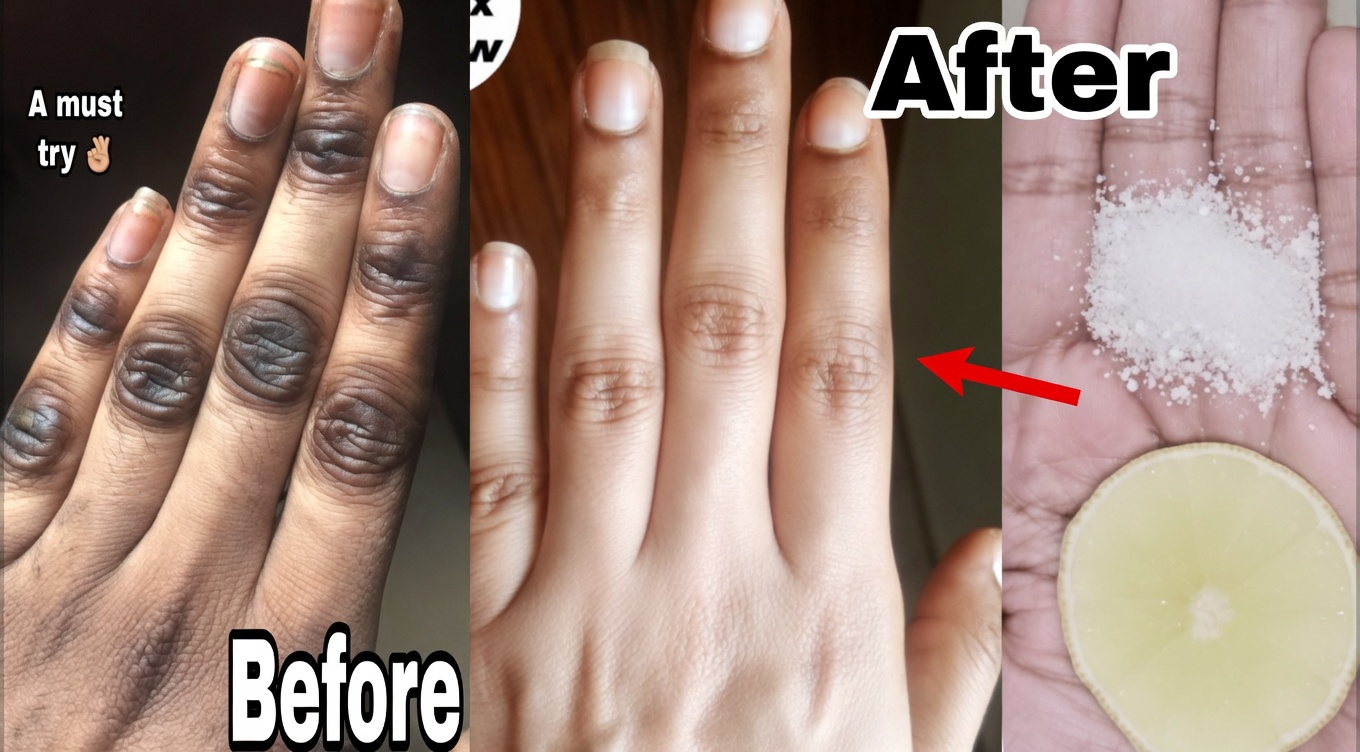 How I Keep My Hands Soft, Wrinkle-Free, Smooth, and Younger-Looking — The Simple Lemon + Sugar + Coffee Hand Mask That Actually Works