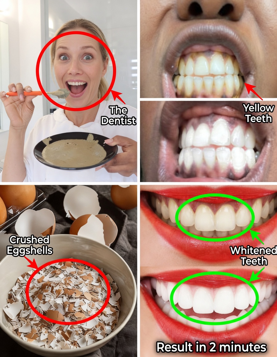 Egg and Coffee Teeth Whitening: The Viral Home Remedy That May Brighten Yellow Teeth – What Really Works and What to Watch Out For