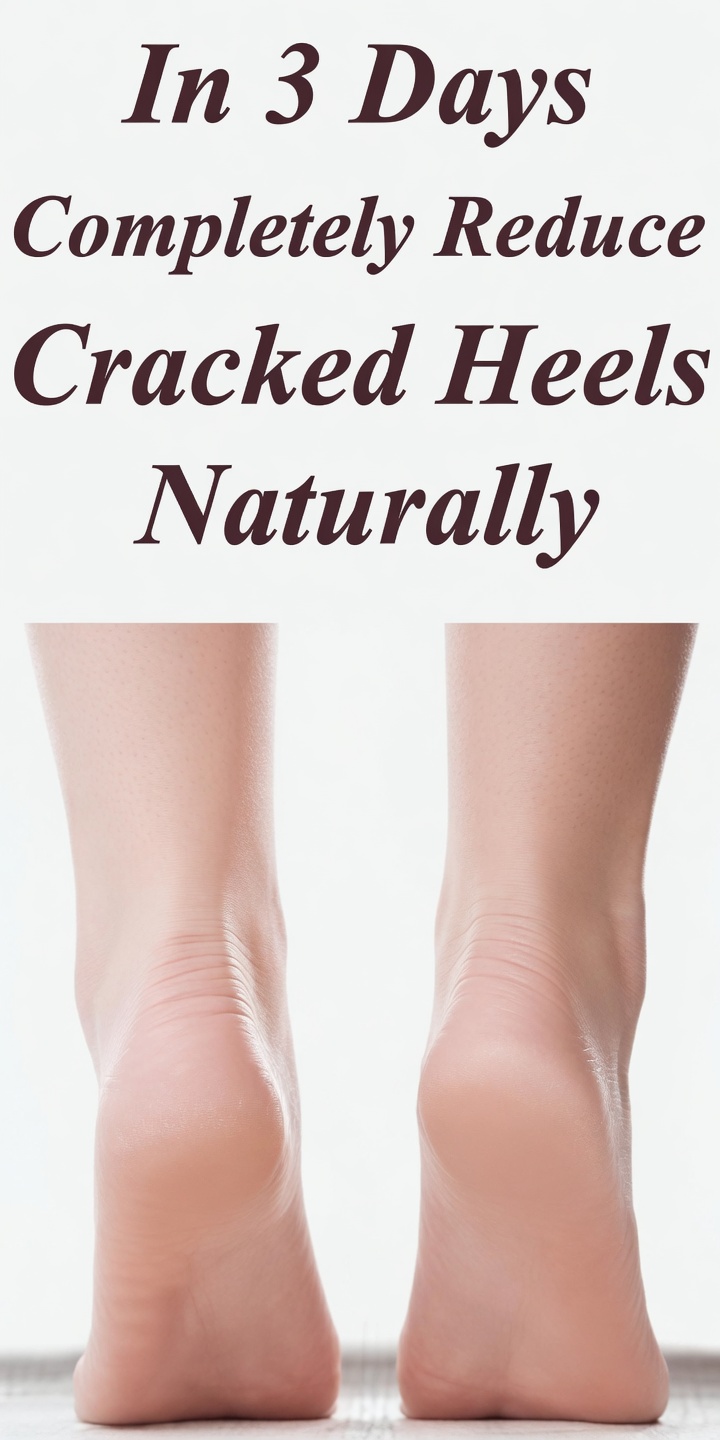 How to Soften and Heal Cracked Heels Naturally with Tomatoes – The Overnight Kitchen Remedy That Delivers Smoother Feet Fast