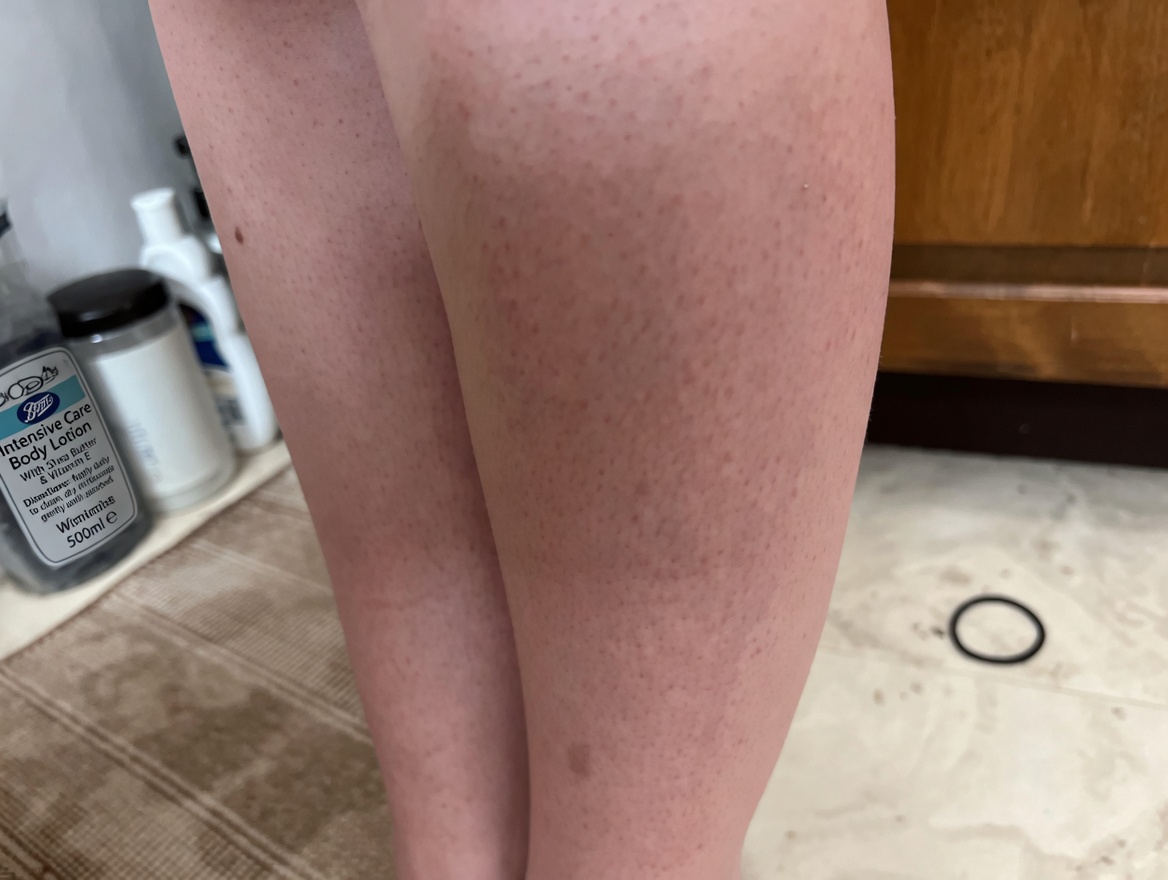 Stop the Shaving Struggle: Is Onion and Toothpaste the Natural Hair Removal Secret You’ve Been Waiting For?