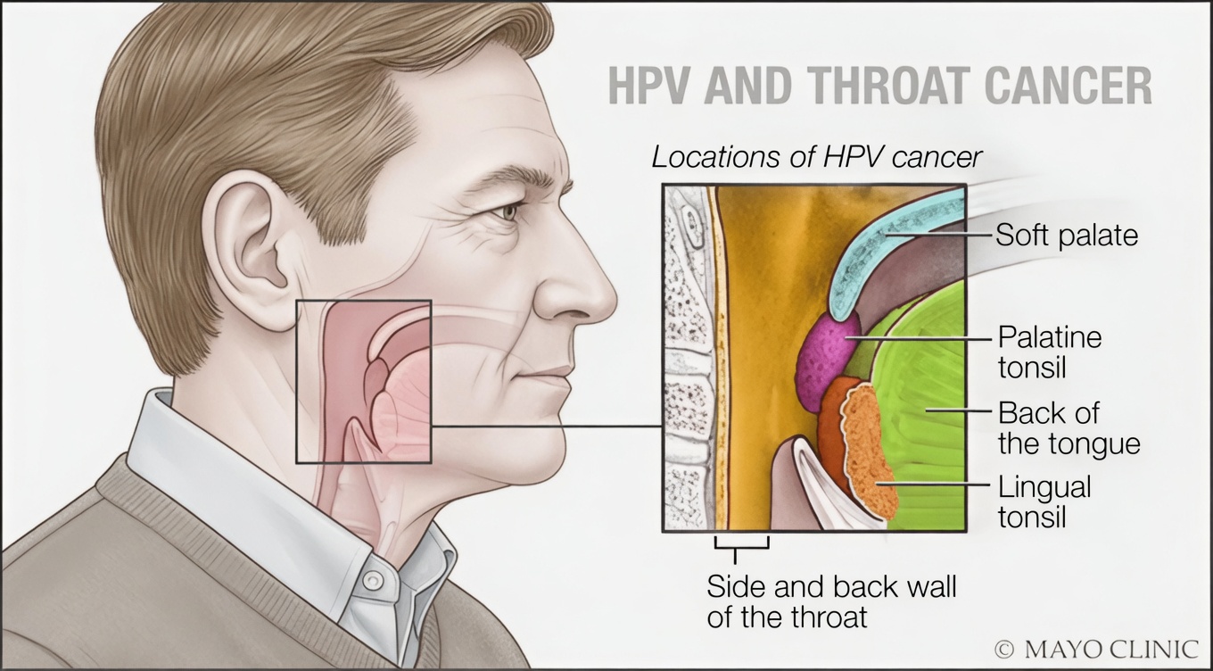 What Are the Common Symptoms of HPV in the Throat? Key Signs You Need to Know
