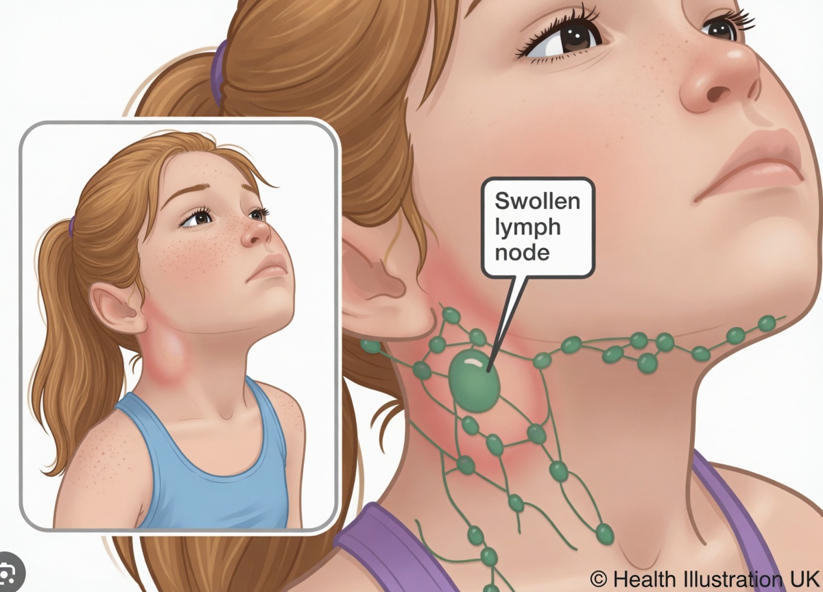 What Are the Common Symptoms of HPV in the Throat? Key Signs You Need to Know