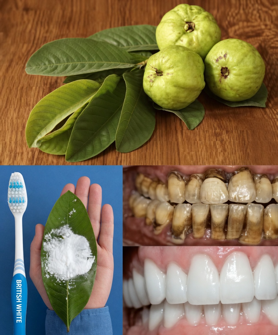 Top 3 Ways to Treat Tooth Decay with Guava Leaves – Simple and Cost-Effective