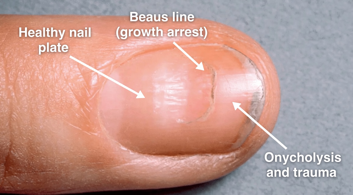 8 Imperceptible Changes in Your Body That Could Be Warning of Health Problems