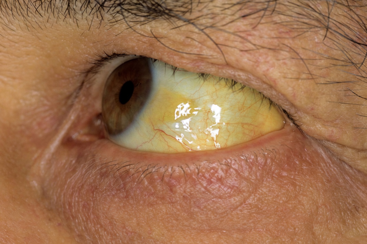 8 Imperceptible Changes in Your Body That Could Be Warning of Health Problems