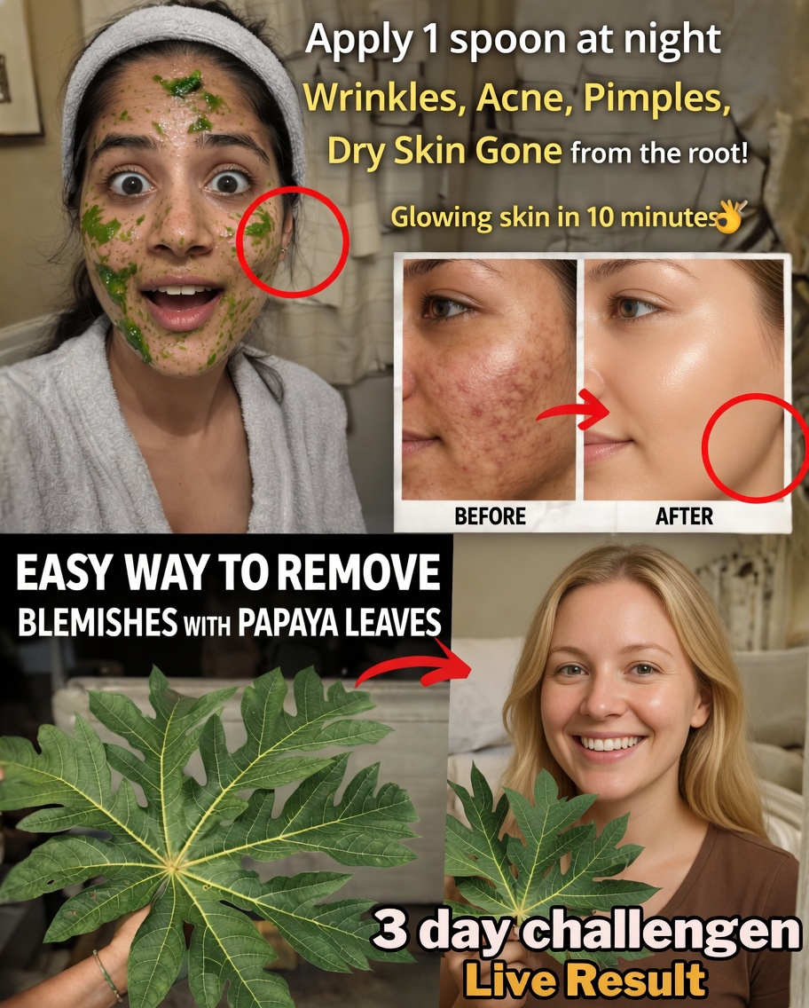 The Surprising Papaya Leaf Remedy That’s Helping Thousands Fade Melasma, Pigmentation, and Discoloration Naturally