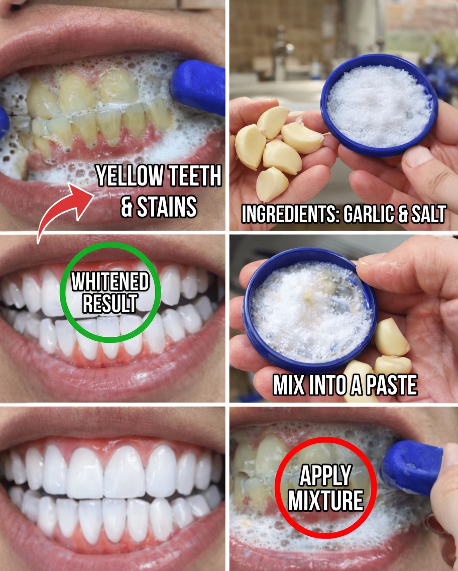 Brighten Your Smile Quickly: Simple Home Teeth Whitening Tricks in Minutes