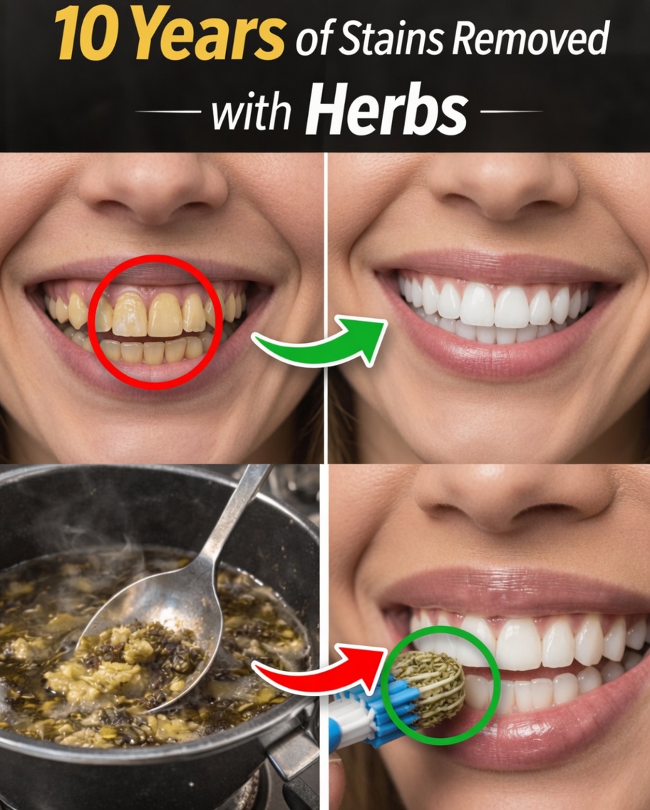 Is Your Morning Coffee Staining Your Teeth? Here’s What You Can Do About It